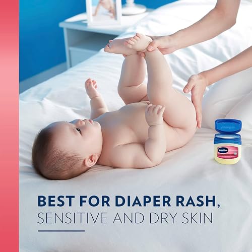 Vaseline Petroleum Jelly Baby Skincare Protective & Pure 4 Count Treats Dry Skin And Prevents Chaffed Skin From Diaper Rash Hypoallergenic And Gentle On Skin 13oz
