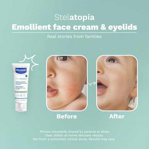 Mustela Stelatopia Eczema-Prone Skin Emollient Baby Face Cream - Face Moisturizer with Natural Avocado & Sunflower Oil - Fragrance-Free - 1.35 fl. oz.