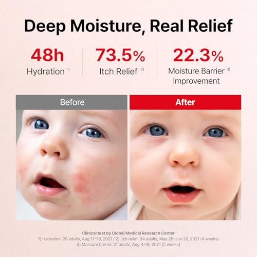 ATOPALM MLE Eczema Cream, 5.6 fl oz (160ml)