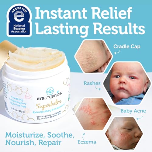 Era Organics Healing Ointment for Babies - USDA Certified Organic Natural Moisturizer Gentle on Sensitive Skin Prone To Baby Eczema, Cradle Cap (Infant Seborrheic Dermatitis), Rashes, Hives 2oz
