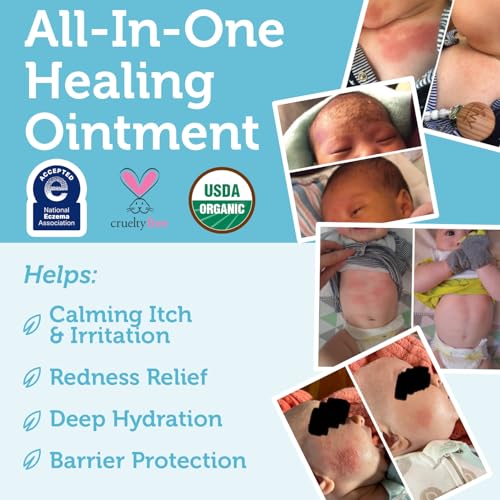 Era Organics Healing Ointment for Babies - USDA Certified Organic Natural Moisturizer Gentle on Sensitive Skin Prone To Baby Eczema, Cradle Cap (Infant Seborrheic Dermatitis), Rashes, Hives 2oz